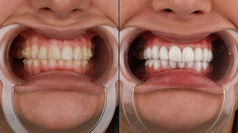 Résultats pour Maya